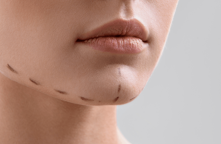 подбородок