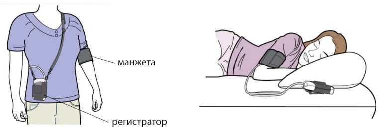 принцип работы аппарата