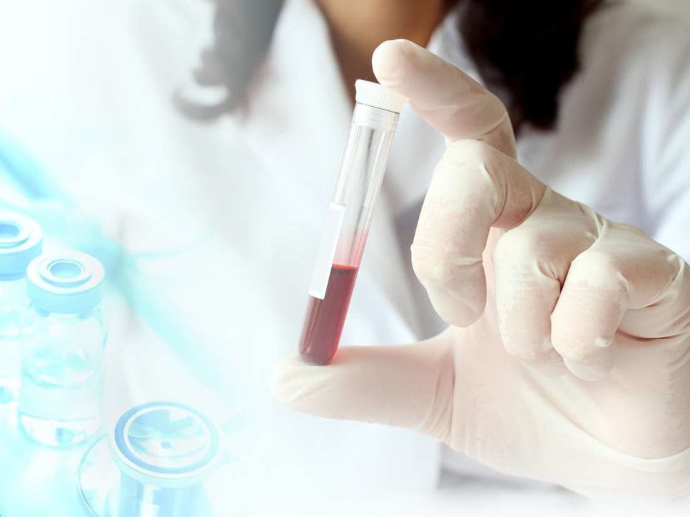 Щелочная фосфатаза