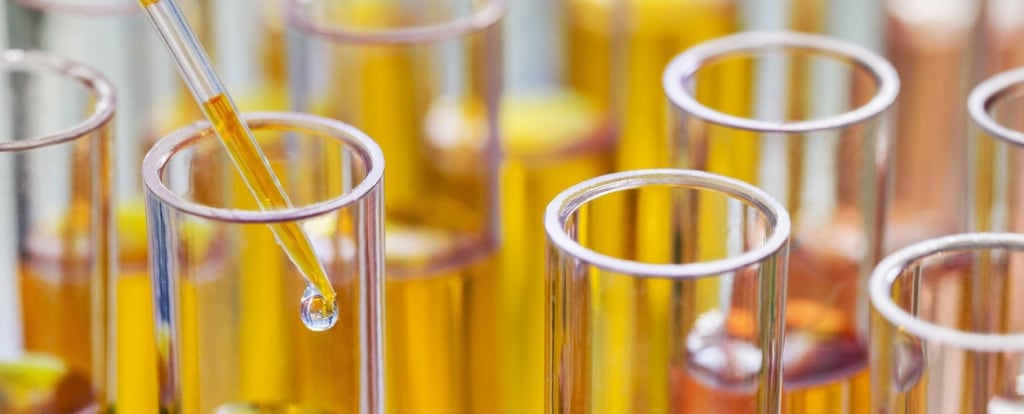 плотность мочи