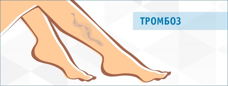 пробемы с ногами