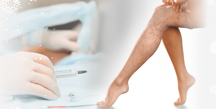 восстановление