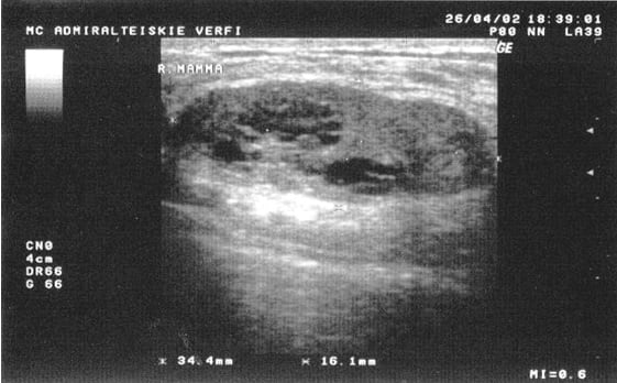 как выглядит УЗИ