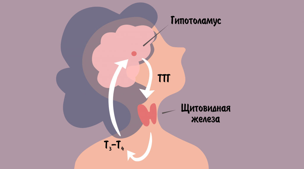т4