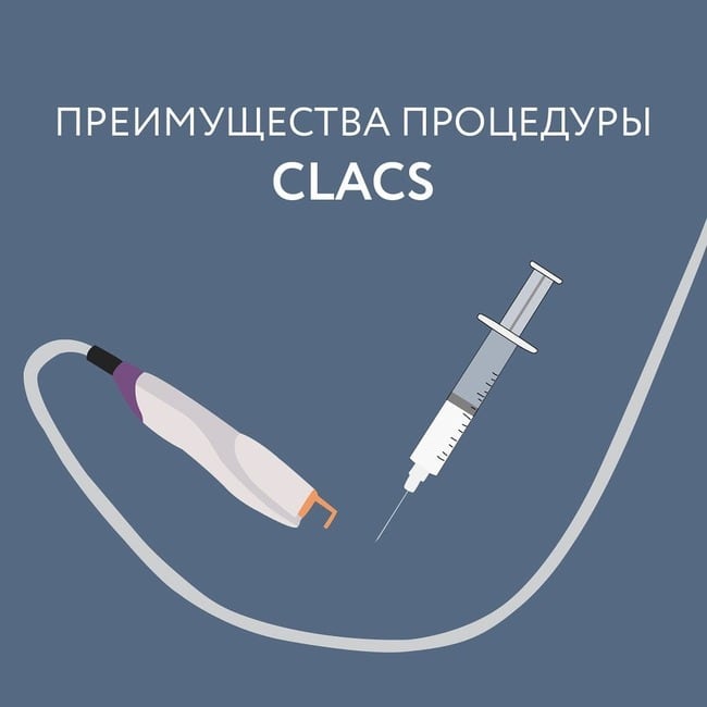 Преимущества процедуры