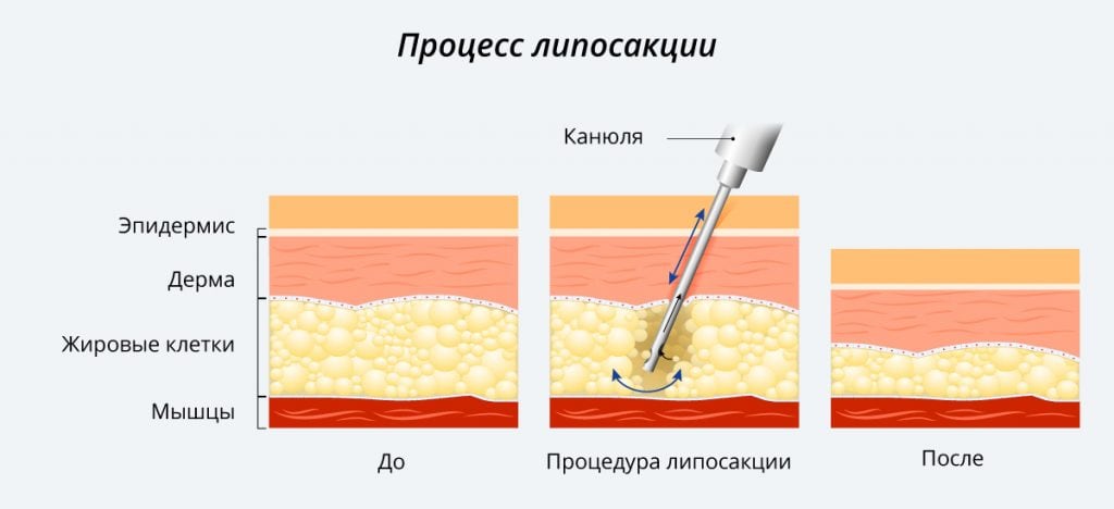 Процесс