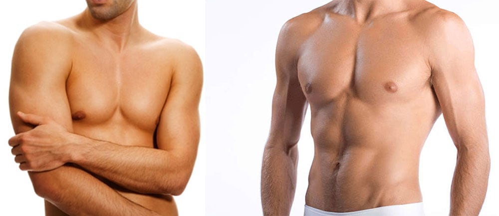 Профилактика