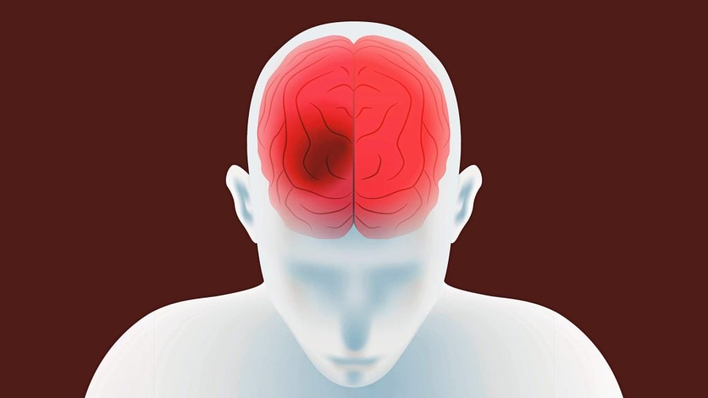 пульсирующая головная боль